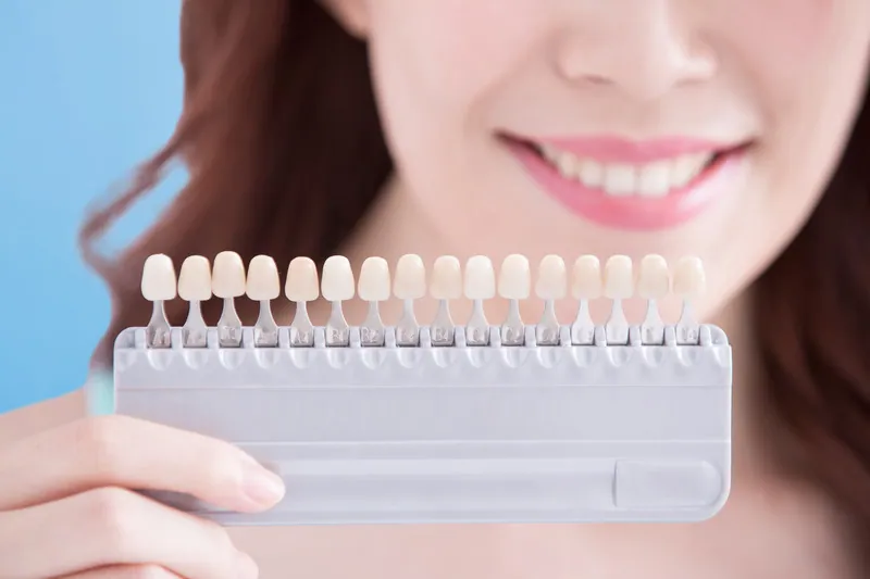 Transform Your Smile with Porcelain Veneers: A Guide