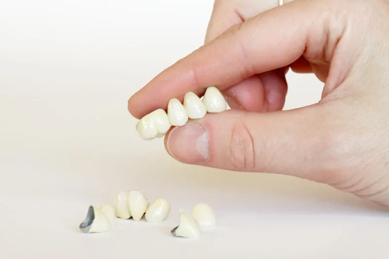 When Do You Need a Dental Crown? Find Out